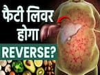 फैटी लिवर ठीक हो सकता है? जानें डाइट और लाइफस्टाइल में क्या करें बदलाव
