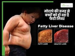 बच्चों में मोटापा बन रहा है फैटी लिवर का कारण, जानिए कैसे रखें उन्हें सुरक्षित