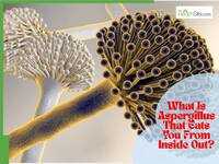 Deadly Fungal Infection Cluster At Sydney Hospital Leaves 2 Dead, 4 Critically Ill: What Is Aspergillus That Eats You From Inside Out?