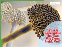 Deadly Fungal Infection Cluster At Sydney Hospital Leaves 2 Dead, 4 Critically Ill: What Is Aspergillus That Eats You From Inside Out?