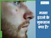 मस्सा हटाने के नुकसान क्या हैं? जानिए किन समस्याओं का रहता है खतरा