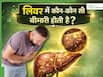 लिवर में कौन-कौन सी बीमारी होती है? डॉक्टर से जानिए कैसे करें Liver खराब होने की पहचान