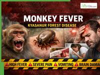Deadly Monkey Fever Strikes Karnataka: Multiple Deaths Reported, Severe Body Pain, Vomiting, Brain Damage Risk