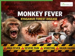 Deadly Monkey Fever Strikes Karnataka: Multiple Deaths Reported, Severe Body Pain, Vomiting, Brain Damage Risk | Full Facts Inside