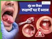 मुंह का कैंसर शुरू होने पर दिखाई देते हैं ये 5 लक्षण, समय पर जांच है बहुत जरूरी