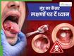 मुंह का कैंसर शुरू होने पर दिखाई देते हैं ये 5 लक्षण, समय पर जांच है बहुत जरूरी