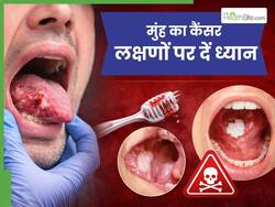 मुंह का कैंसर शुरू होने पर दिखाई देते हैं ये 5 लक्षण, समय पर जांच है बहुत जरूरी