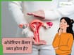 ओवेरियन कैंसर का पता क्यों नहीं चल पाता है? डॉक्टर से जानें महिलाओं को किन बातों का ध्यान रखना चाहिए