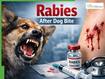 Rabies After Dog Bite: Treatment Protocol In India, Vaccine Schedule And What To Do Immediately