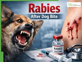 Rabies After Dog Bite: Treatment Protocol In India, Vaccine Schedule And What To Do Immediately
