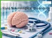Rare Neurological Disorders: Subtle Early Brain Symptoms You Should Never Ignore