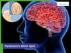 The Parkinson’s Blind Spot: New Findings Shift Focus To Forgotten Brain Regions