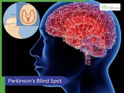 The Parkinson   s Blind Spot: New Findings Shift Focus To Forgotten Brain Regions