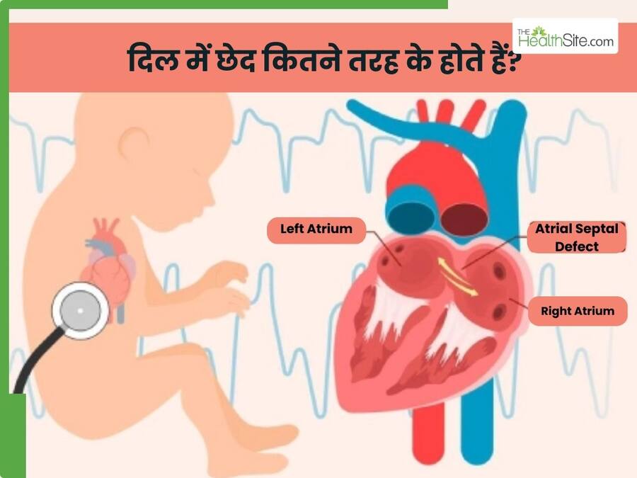 दिल में छेद कितने प्रकार के होते हैं? डॉक्टर ने समझाया किसमें है ज्यादा खतरा