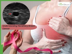 Hereditary Breast Cancer: Understanding The Role Of BRCA Gene Mutations