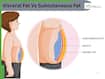 Visceral Fat Vs Subcutaneous Fat: Which Type of Body Fat Is More Dangerous for Your Health?