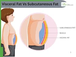 Visceral Fat Vs Subcutaneous Fat: Which Type of Body Fat Is More Dangerous for Your Health?