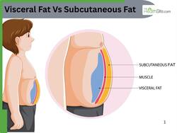 Visceral Fat Vs Subcutaneous Fat: Which Type of Body Fat Is More Dangerous for Your Health?