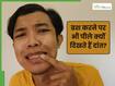 पीले दांत क्यों होते हैं? जानिए इसके पीछे की वजह और कैसे इसकी सफाई