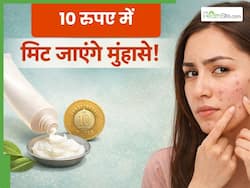 10 रुपए की इस चीज से दूर हो जाएंगे आपके मुंहासे, इन 2 तरीकों से लगाएंगे तो मिलेगा फायदा