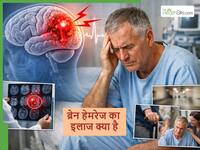 सलीम खान हेल्थ: ब्रेन हेमरेज के बाद क्या होता है, जानें ट्रीटमेंट-रिकवरी सब कुछ