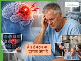 सलीम खान हेल्थ: ब्रेन हेमरेज के बाद क्या होता है, जानें ट्रीटमेंट-रिकवरी सब कुछ सलीम खान हेल्थ: ब्रेन हेमरेज के बाद क्या होता है, जानें ट्रीटमेंट-रिकवरी सब कुछ