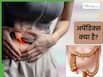 पेट के दाहिने हिस्से का दर्द: कहीं अपेंडिक्स तो नहीं? जानें क्या हैं इसके लक्षण और कारण