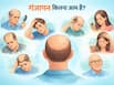 गंजापन कितना आम है? जानें पुरुष या महिला, किसे होता है ज्यादा हेयर फॉल