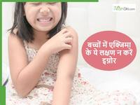 बच्चों की स्किन में बार-बार खुजली और लालिमा कहीं Eczema, ये शुरुआती लक्षण गलती से भी न करें इग्नोर