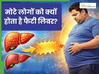 मोटापा बनता जा रहा है फैटी लिवर का कारण, इन लक्षणों की न करें अनदेखी