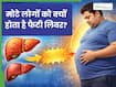 मोटापा बनता जा रहा है फैटी लिवर का कारण, इन लक्षणों की न करें अनदेखी