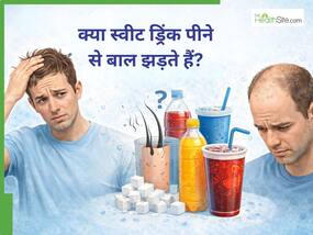 क्या स्वीट ड्रिंक्स पुरुषों में बाल झड़ने की वजह बनते हैं? जानें क्या है असली सच्चाई क्या स्वीट ड्रिंक्स पुरुषों में बाल झड़ने की वजह बनते हैं? जानें क्या है असली सच्चाई