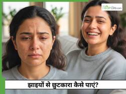 चेहरे की झाइयों से छुटकारा कैसे पाएं? जानें 5 नुस्खे जो जड़ से खत्म करेंगे समस्या