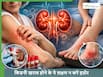 टखने में सूजन से लेकर स्किन में खुजली तक, किडनी डैमेज के ये 5 लक्षण जो अक्सर इग्नोर कर देते हैं लोग