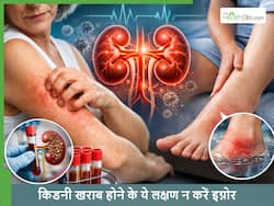 टखने में सूजन से लेकर स्किन में खुजली तक, किडनी डैमेज के ये 5 लक्षण जो अक्सर इग्नोर कर देते हैं लोग
