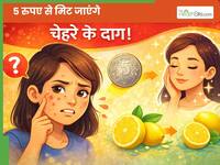 चेहरे के दाग-धब्बों से परेशान हैं? 5 रुपए की इस चीज से मिट जाएंगे सारे काले दाग और पिग्मेंटेशन