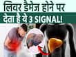 अल्कोहल पीने से लिवर डैमेज होने पर दिखते हैं ये वॉर्निंग साइन! ना करें इसे इग्नोंर