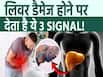 अल्कोहल पीने से लिवर डैमेज होने पर दिखते हैं ये वॉर्निंग साइन! ना करें इसे इग्नोंर