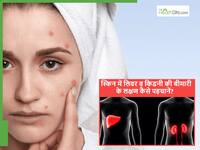 स्किन में दिख रहे ये बदलाव लिवर और किडनी खराब होने का संकेत तो नहीं? डॉक्टर क्यों कर रहे सावधान