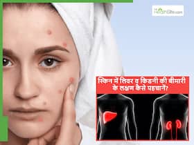 स्किन में दिख रहे ये बदलाव लिवर और किडनी खराब होने का संकेत तो नहीं? डॉक्टर क्यों कर रहे सावधान