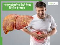 फैटी लिवर की पहचान कैसे करें, ड्रिंक न करने वालों में दिखने दिखते हैं NAFLD के ये 4 लक्षण