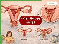 गर्भाशय का कैंसर क्या है? डॉक्टर बता रहे हैं- किन महिलाओं को रहता है सबसे ज्यादा खतरा