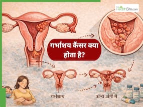 16- गर्भाशय का कैंसर क्या है? डॉक्टर बता रहे हैं- किन महिलाओं को रहता है सबसे ज्यादा खतरा