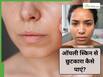 ऑयली स्किन से छुटकारा कैसे पाएं? ये 5 नुस्खें हैं बड़े असरदार
