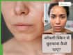 ऑयली स्किन से छुटकारा कैसे पाएं? ये 5 नुस्खें हैं बड़े असरदार