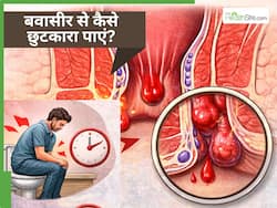 बवासीर की गांठ को जड़ से खत्म कैसे करें? जानें Piles से जुड़ी एक-एक जरूरी बात