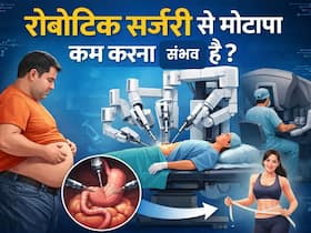 क्या रोबोटिक सर्जरी से मोटापे को कम किया जा सकता है? जानें ओवरवेट वाले लोगों के लिए क्या है बेस्ट ऑप्शन