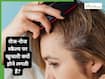 2 दिन हेयर वॉश न करने पर स्कैल्प पर खुजली क्यों होती है? जानें कैसे दूर होगी समस्या