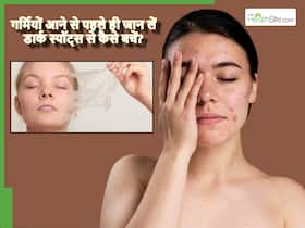 गर्मियां आने से पहले ही बदल लें ये 4 आदतें, अपने आप दूर होने लगेंगे चेहरे के काले धब्बे