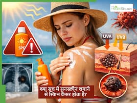क्या सनस्क्रीन का इस्तेमाल करने से स्किन कैंसर का खतरा बढ़ता है? Dermatologist से जानें